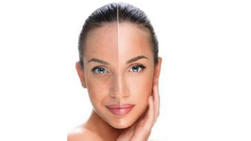 skin laser treatment in anna nagar west, mogappaikr, best skin treatment in anna nagar, skin clinic in anna nagar mogappair, best cosmetologist in anna nagar, skin hair, body hair treatment anna nagar & mogappair