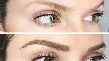 skin laser treatment in anna nagar west, mogappaikr, best skin treatment in anna nagar, skin clinic in anna nagar mogappair, best cosmetologist in anna nagar, skin hair, body hair treatment anna nagar & mogappair