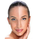 skin laser treatment in anna nagar west, mogappaikr, best skin treatment in anna nagar, skin clinic in anna nagar mogappair, best cosmetologist in anna nagar, skin hair, body hair treatment anna nagar & mogappair